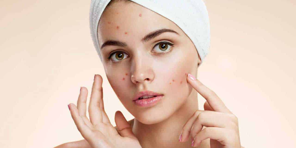 different-types-of-skin-blemishes-separet-page